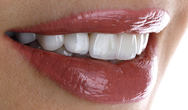 turkey zirconia crown